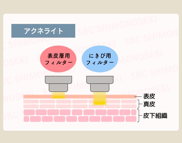 【アクネライト】光エネルギーでアクネ菌を殺菌！
