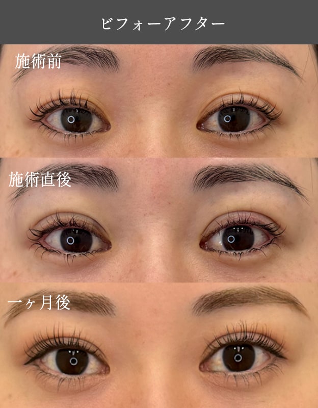 術後経過