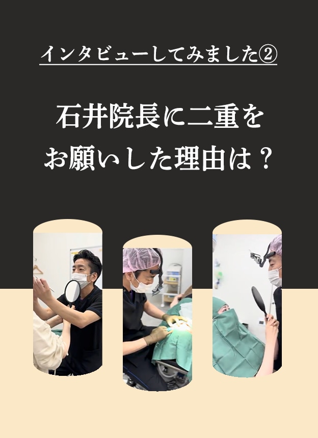 実際に二重整形のお客様の・・