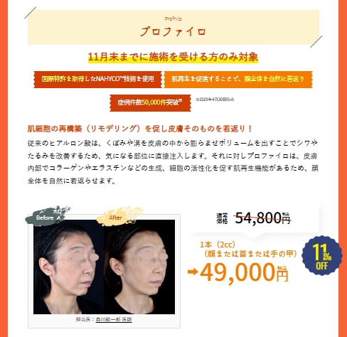 プロファイロ詳細はこちら