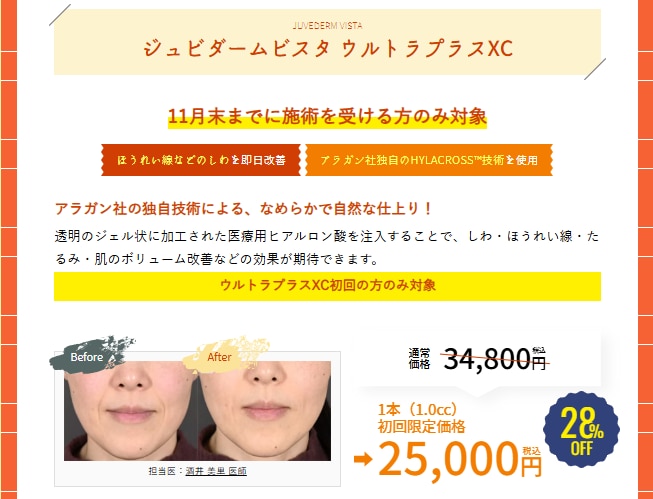 ウルトラプラスXC詳細はこちら