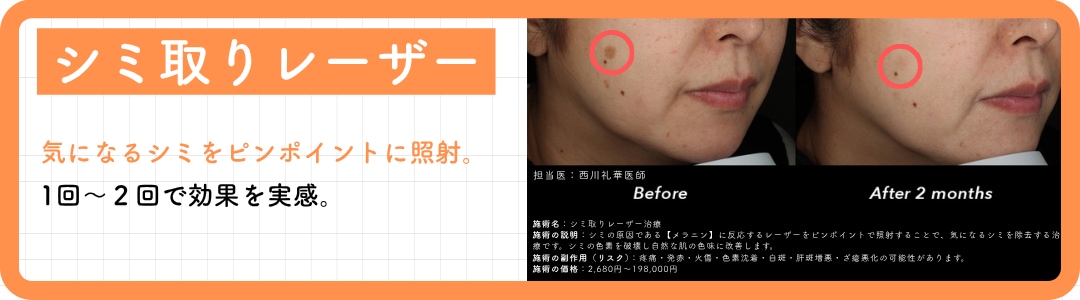 【CASE 1】シミ・そばかす・くすみを改善したい
