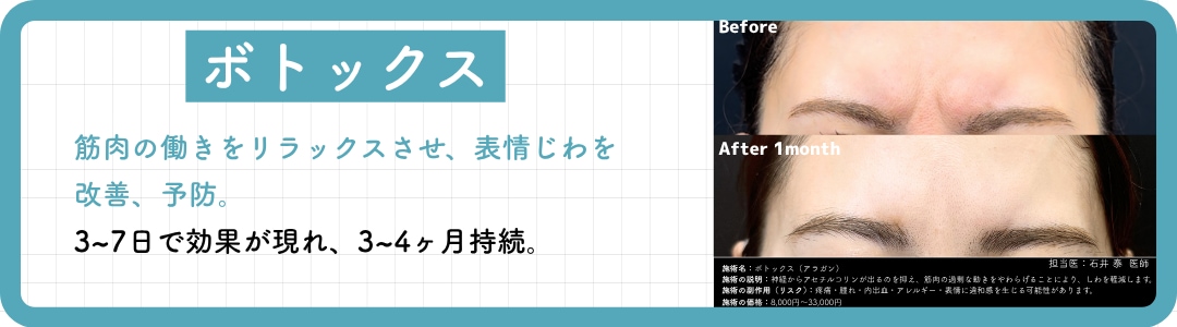 【CASE 2】しわを改善・予防したい