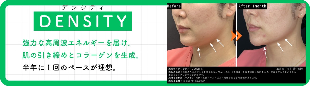 【CASE 3】たるみを引き締めたい