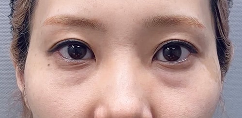 頬骨が張っている方