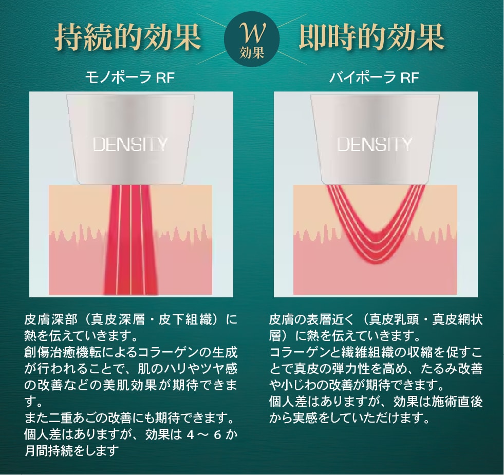 モノポーラ+バイポーラのモノバイ技術