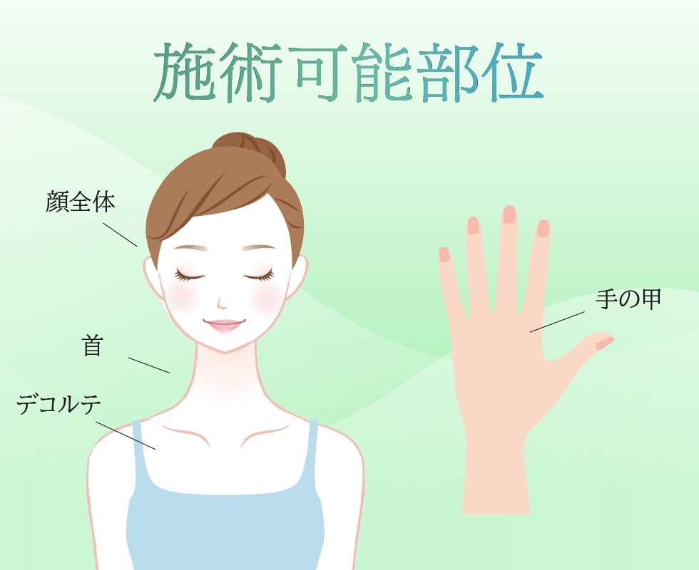 どこに施術できるの？