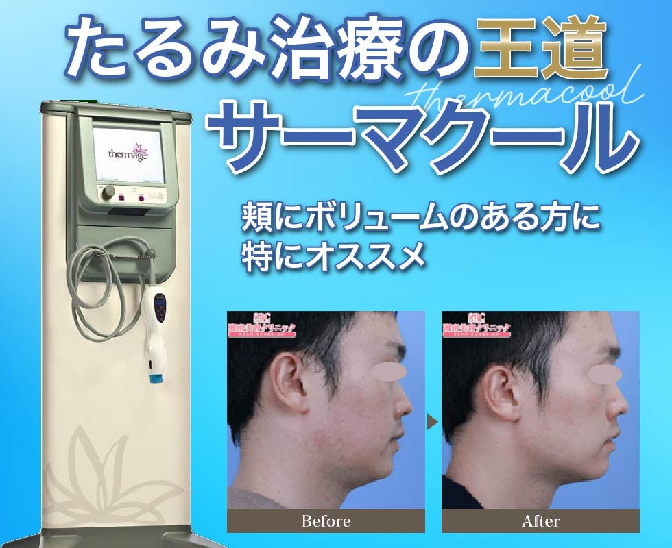 サーマクールCPTとは