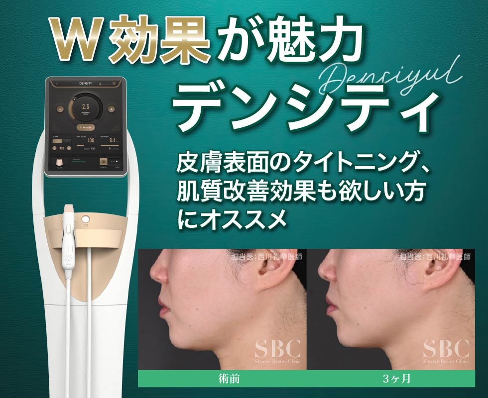 デンシティとは