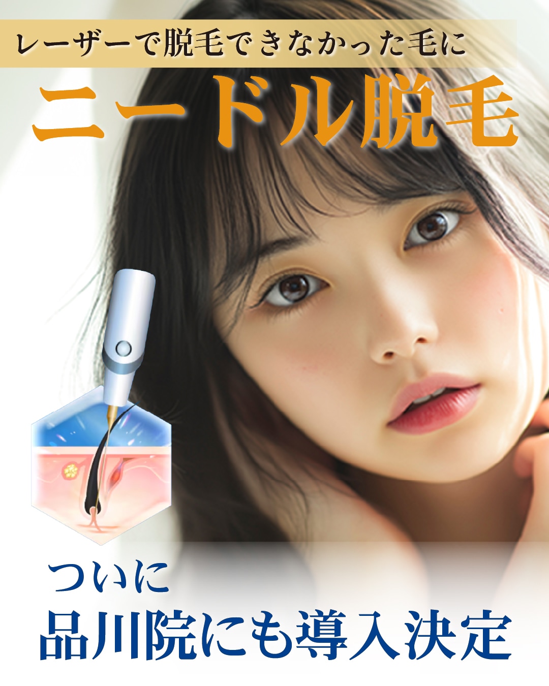 レーザーで脱毛できなかった毛にニードル脱毛！品川院に新導入