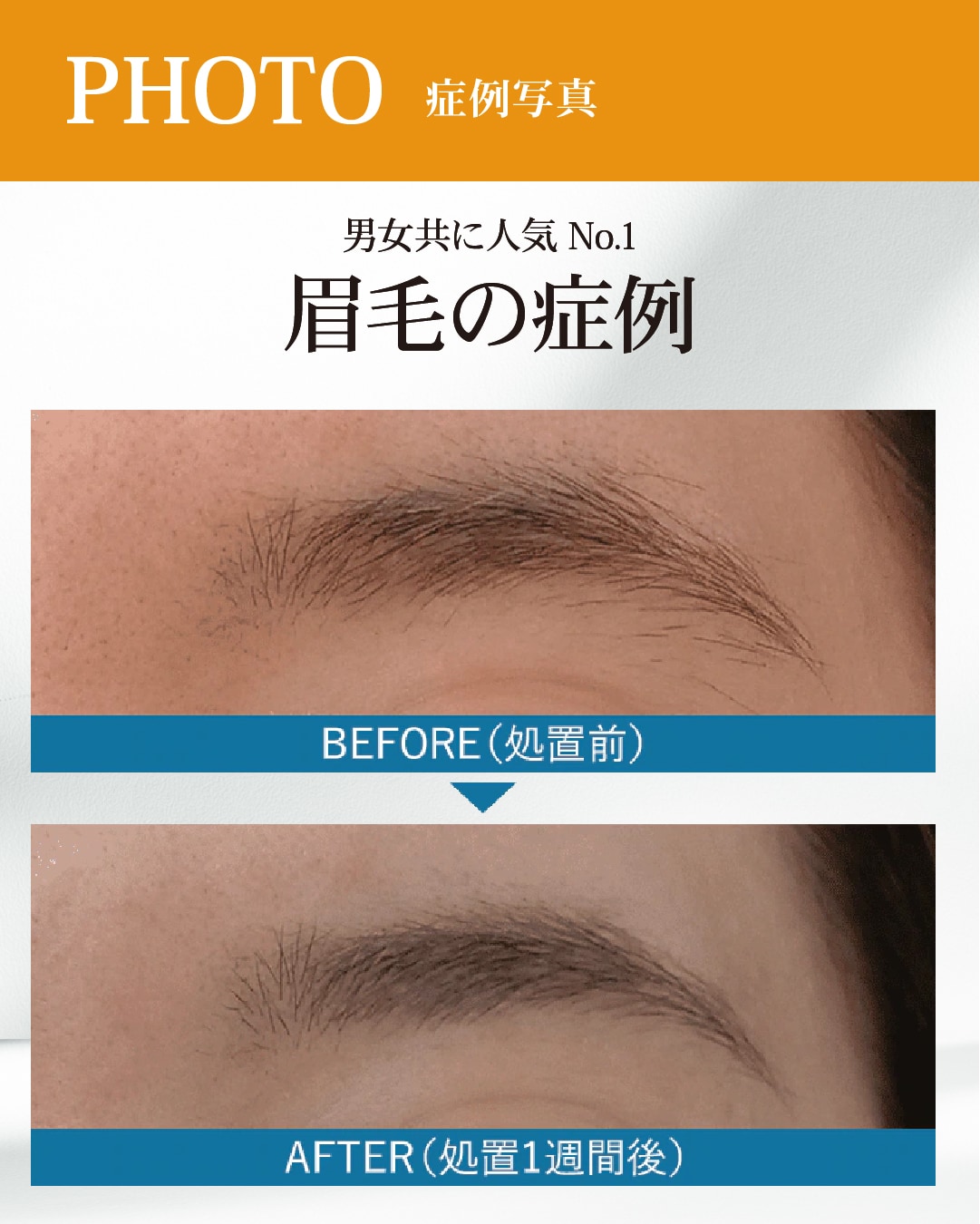 眉毛の症例