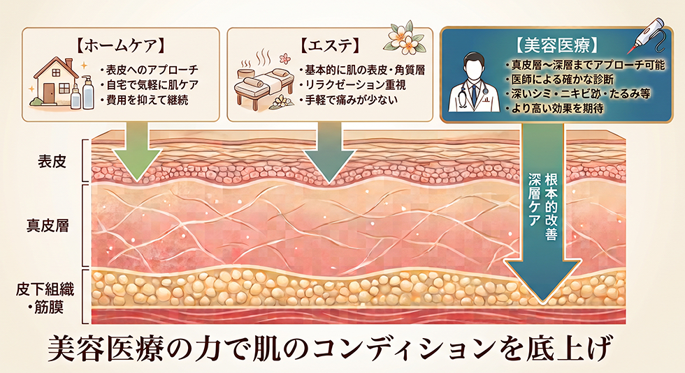 エステやホームケアとの比較