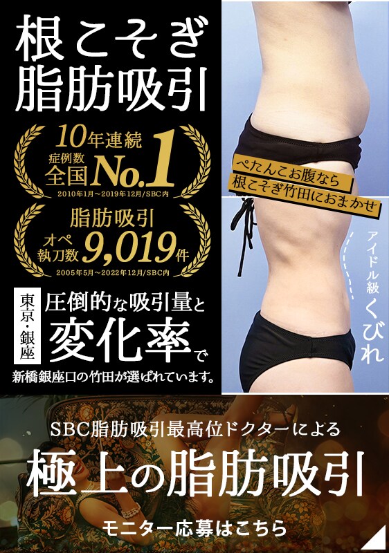東京・銀座で脂肪吸引するなら根こそぎ竹田!極上の脂肪吸引モニター【SBC脂肪吸引最高責任者】