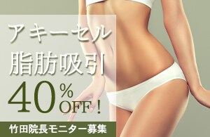 【お肉サヨナラ】竹田先生の脂肪吸引40%オフ！モニター募集！