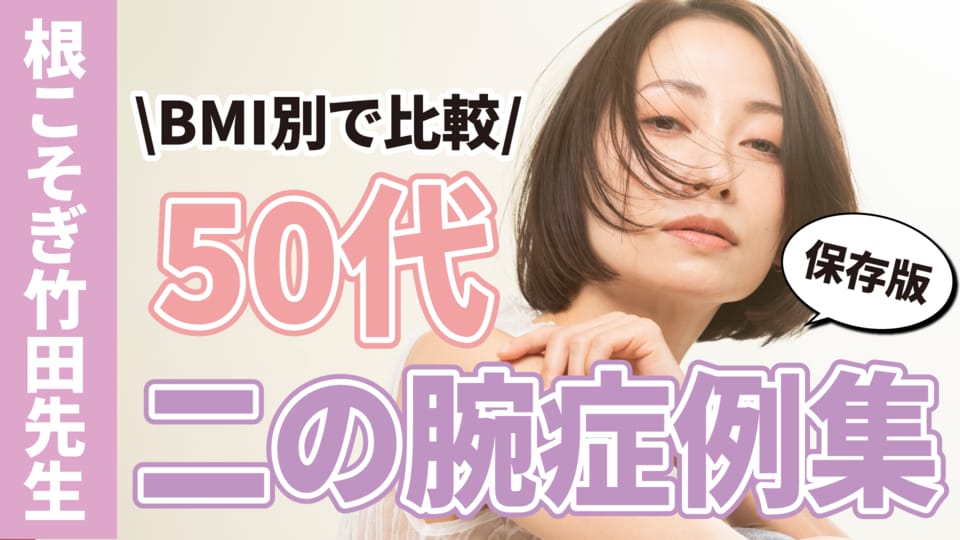 50代・二の腕の脂肪吸引特集｜湘南美容クリニック・東京銀座で名医と言えば【根こそぎ竹田先生】ベイザー・アキーセルどちらも集めました！