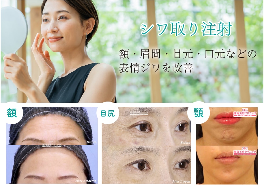 湘南美容クリニック eギフト券 1万円券｜SBC 国内店舗利用可｜即日対応 