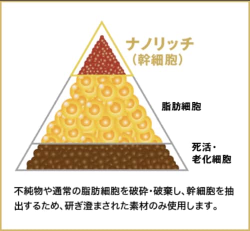 脂肪注入-ナノリッチ-