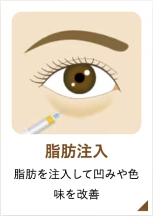 ナチュラル脂肪注入