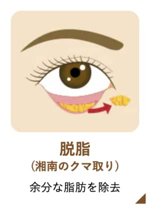 アイバックリムーブ
