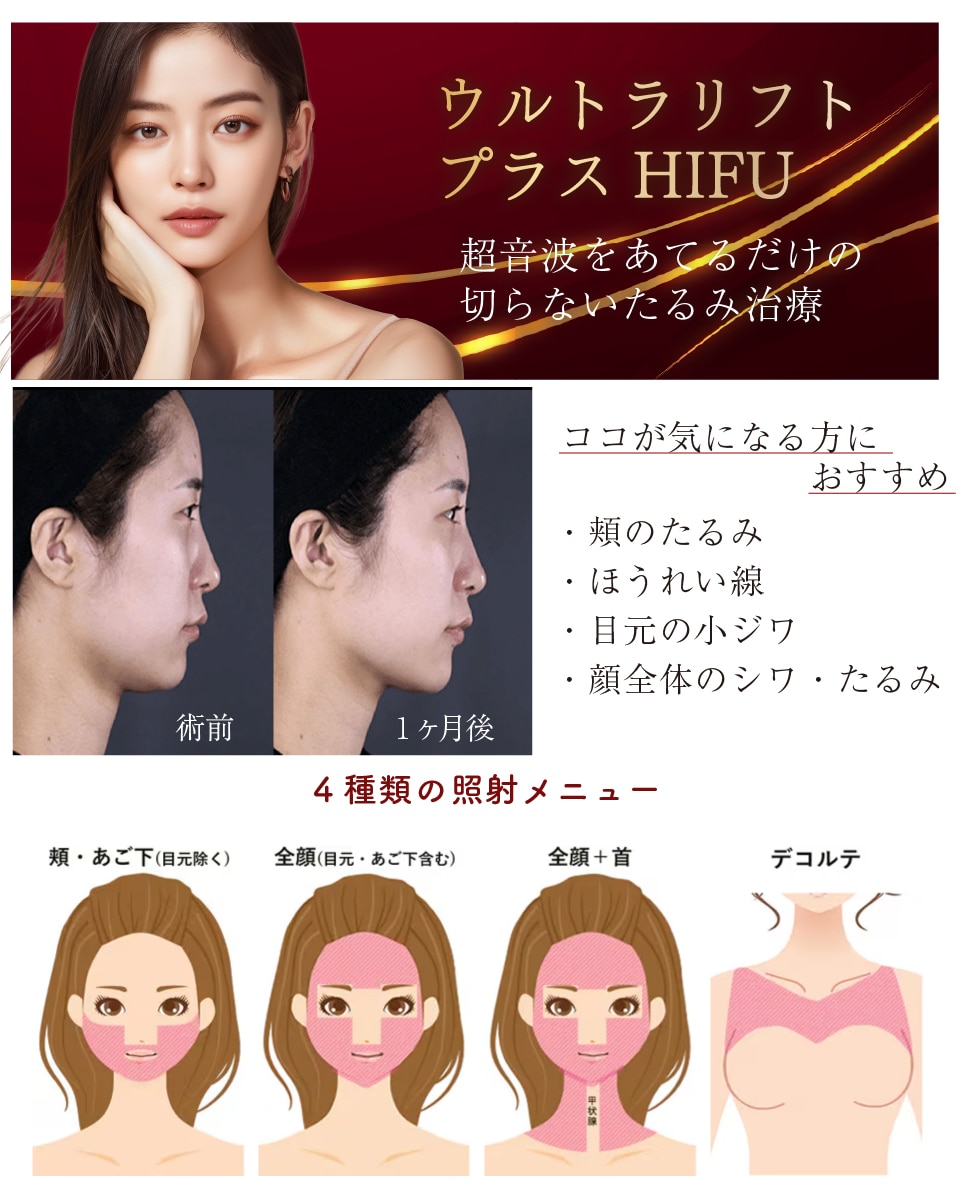【オススメ】ウルトラリフトプラスハイフ