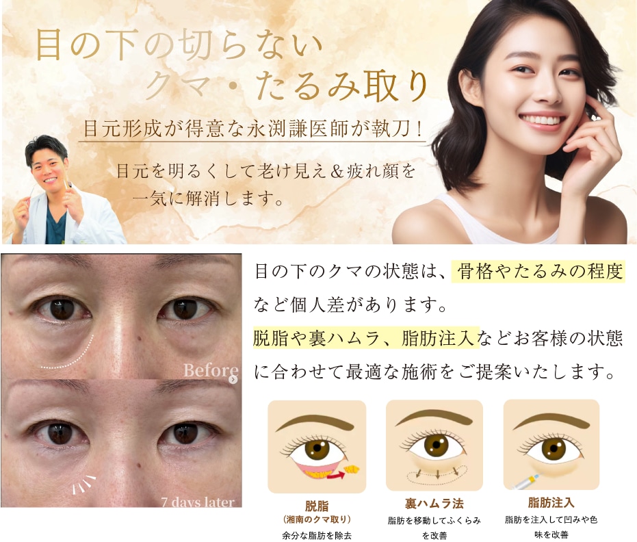 【オススメ】目の下の切らないクマ・たるみ取り