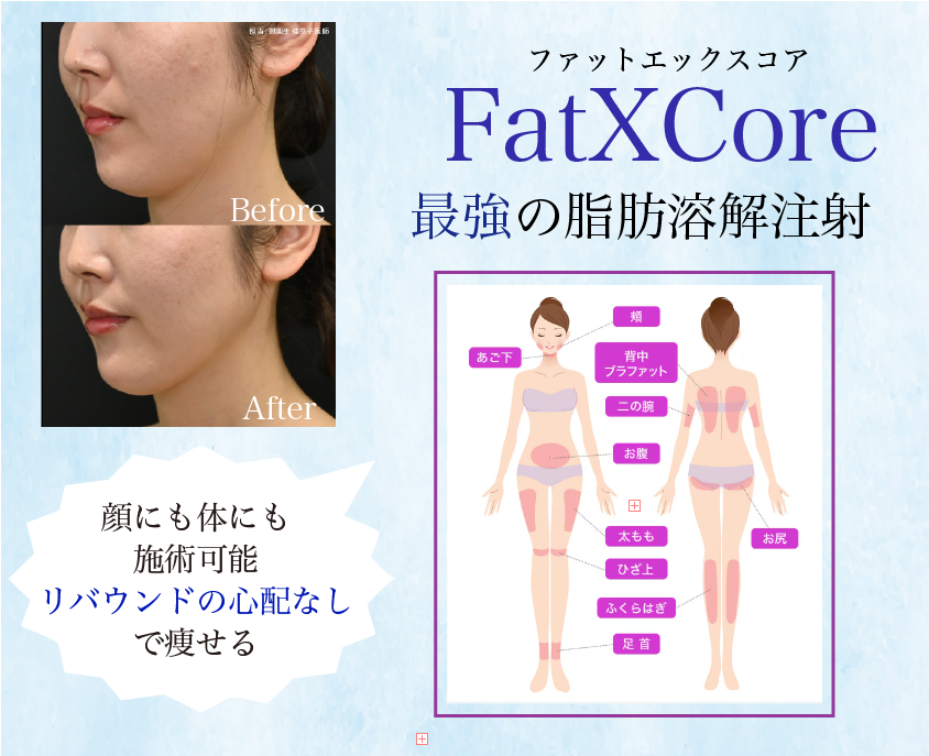 【1万円以下】FatXCore