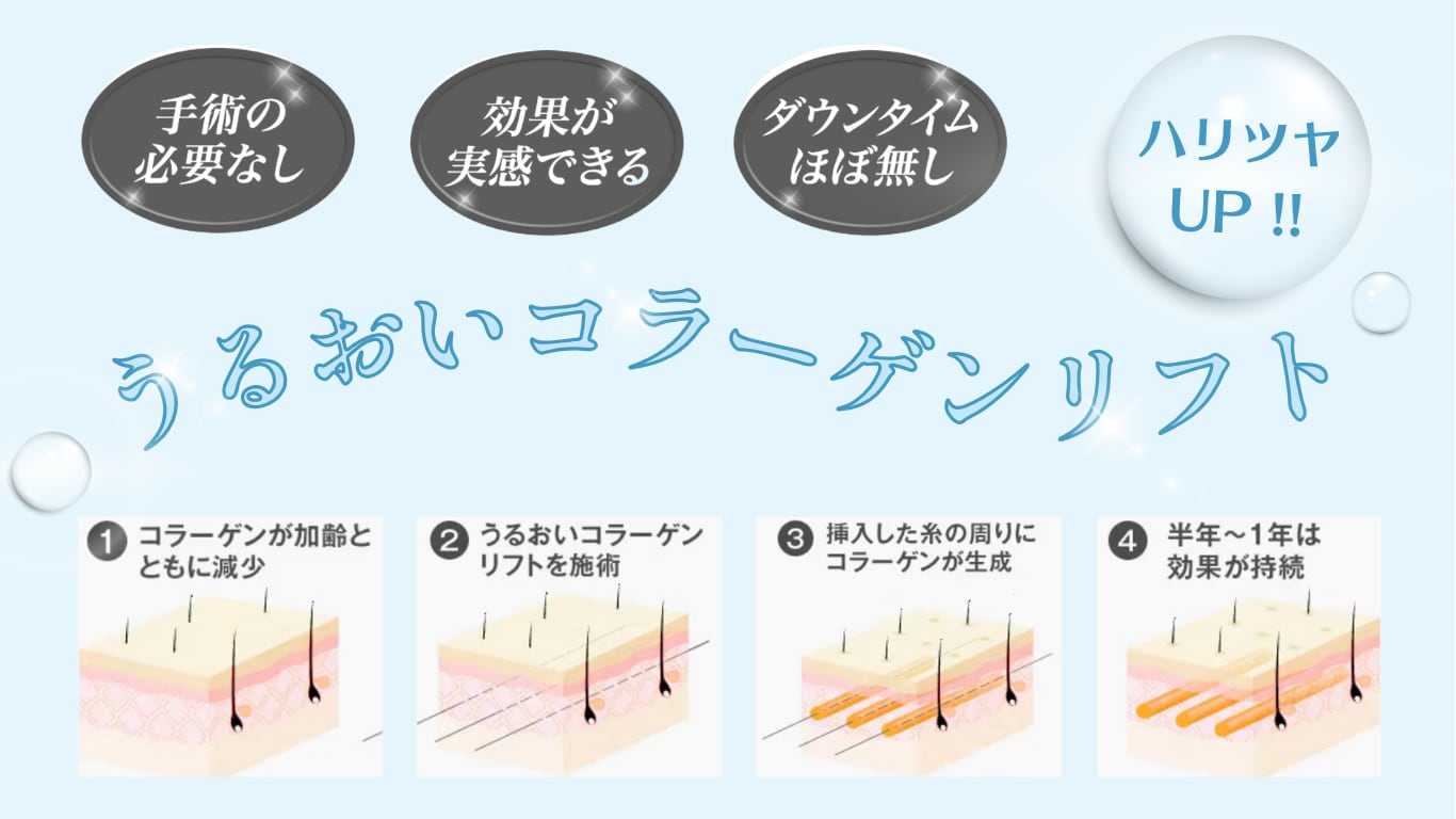うるおいコラーゲンリフト