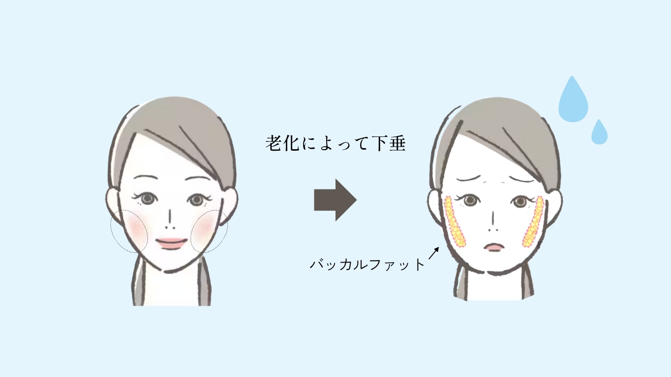 お顔の脂肪が重力で下がる!?