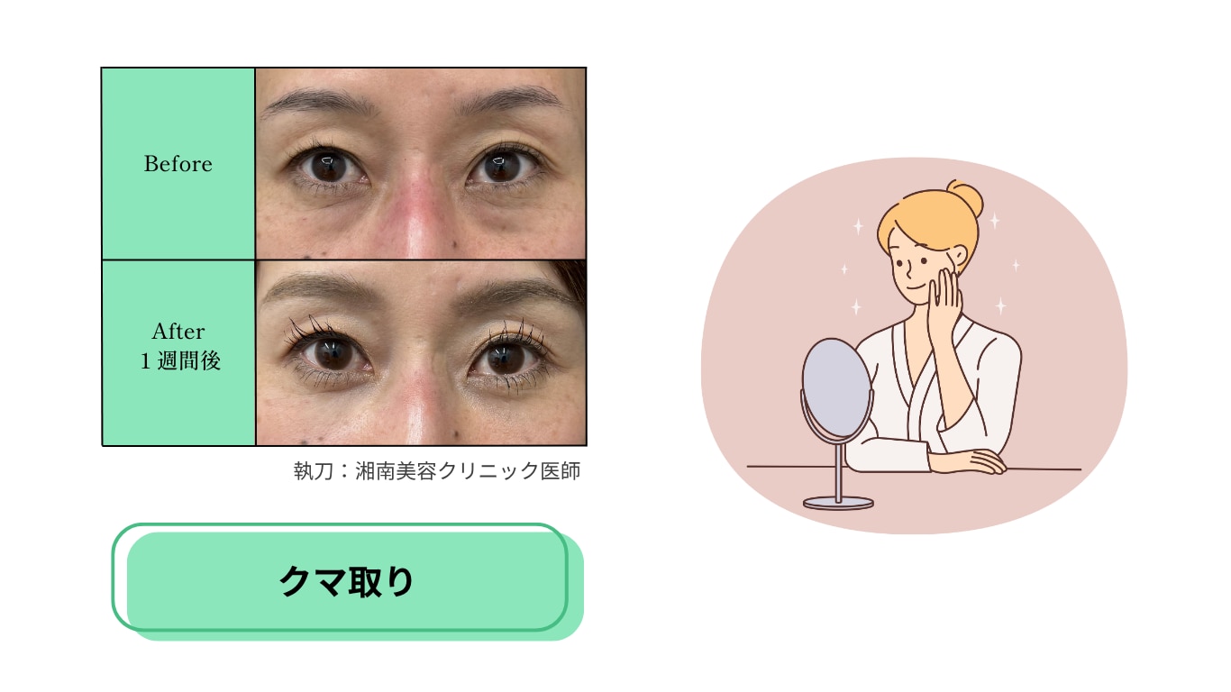 老け見えにサヨナラ!