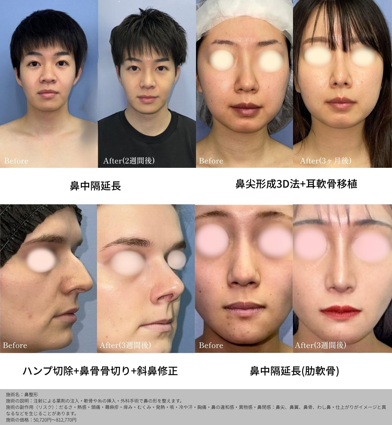 360度美しい鼻へ