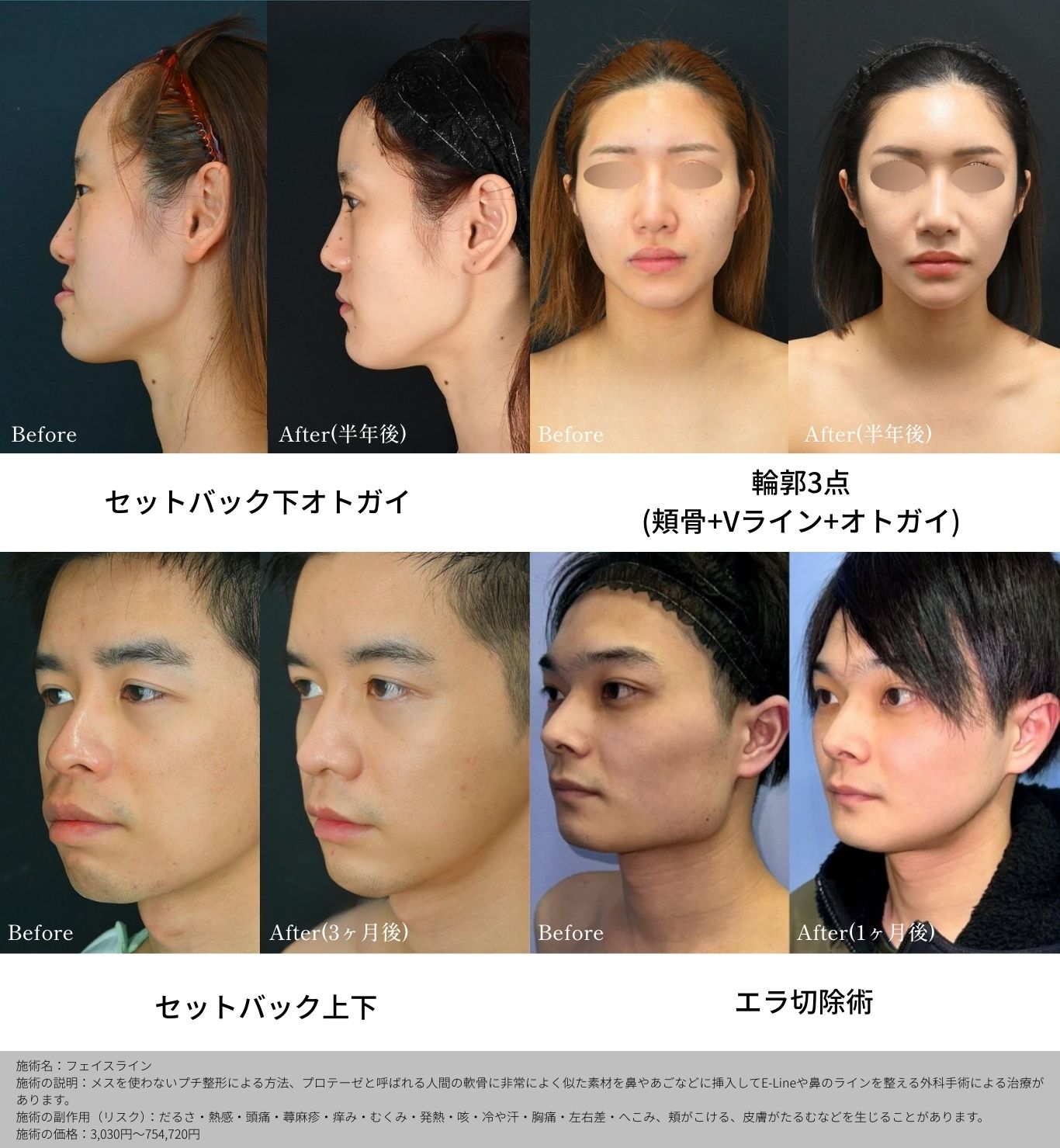 緻密なデザインと腫れの少ないオペ
