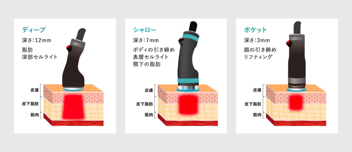 顔も体も照射可能な“脂肪溶解ができる”