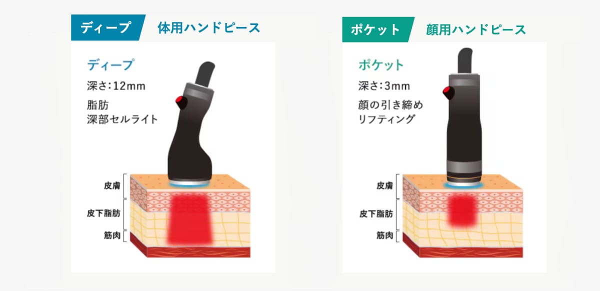 顔も体も照射可能な“脂肪溶解ができる”