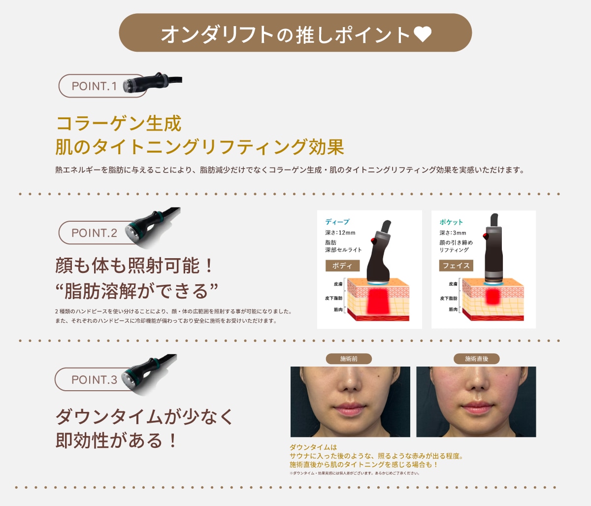 お顔にもお体にも施術可能♡「ダウンタイム最小限で即効性が欲しい！話題の治療を試したい✨」という人におすすめ！