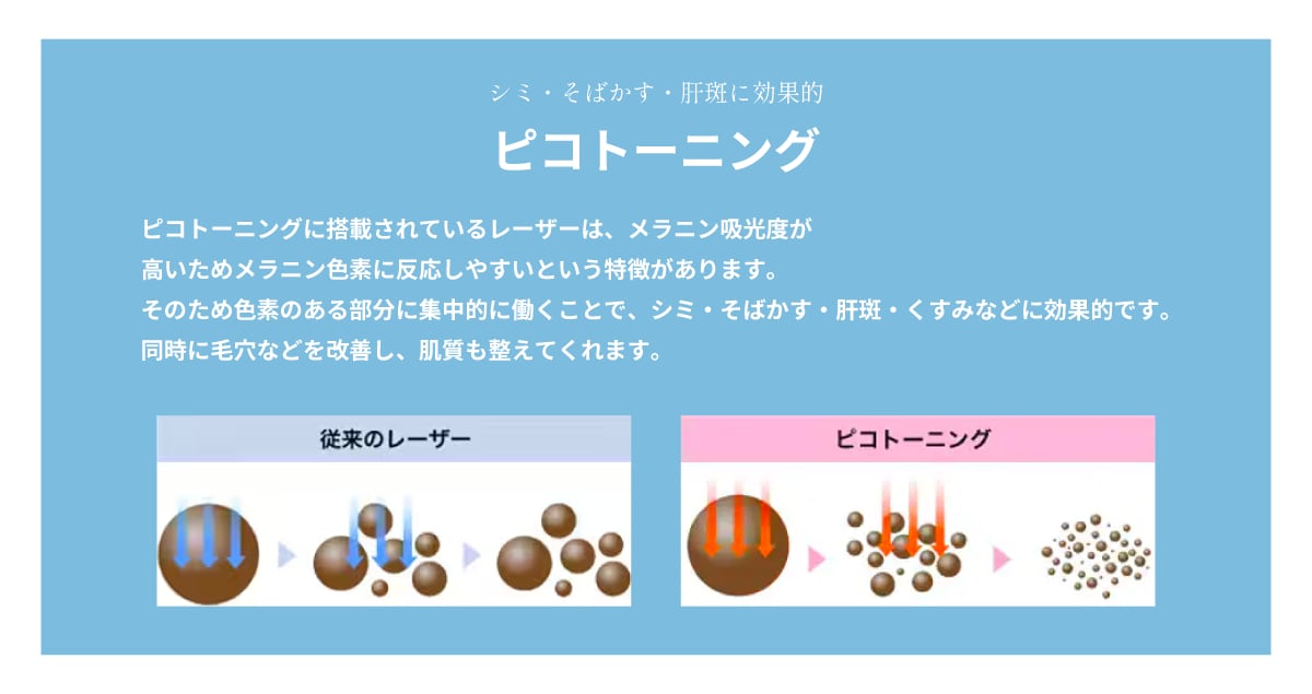 ピコトーニングでメラニンを粉砕させて色素を除去💥