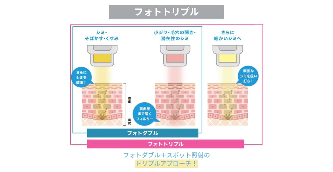 3種類の光を重ねて照射🪄