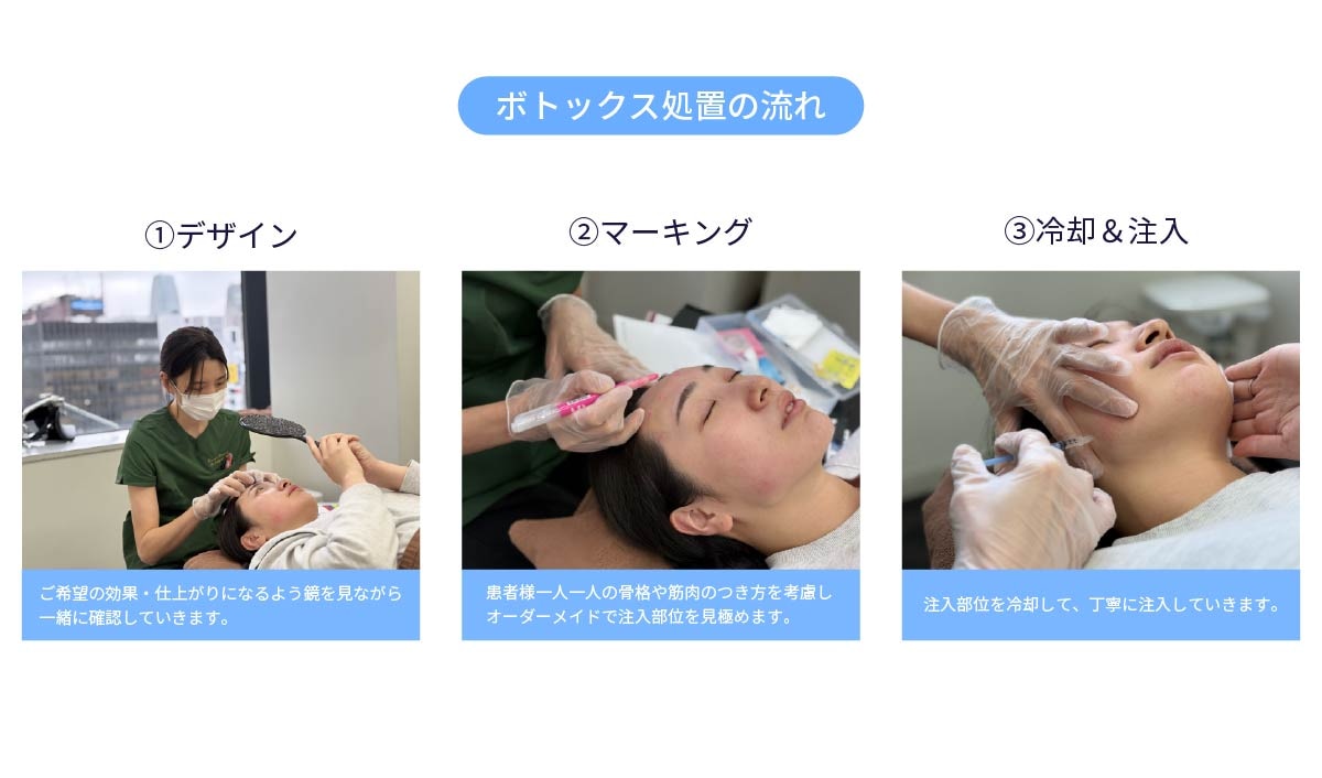 ヨンミョン先生の技術力・施術イメージ