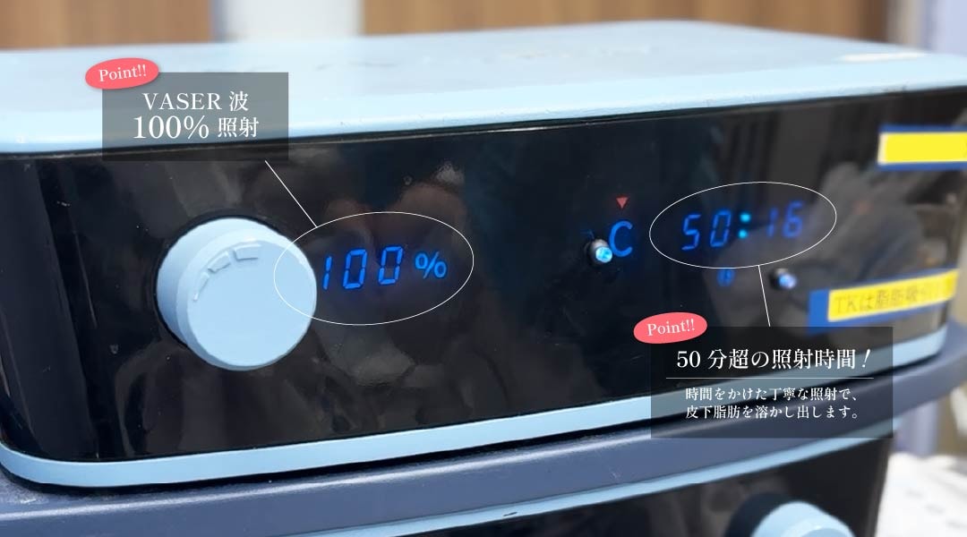 ベイザー技術イメージ