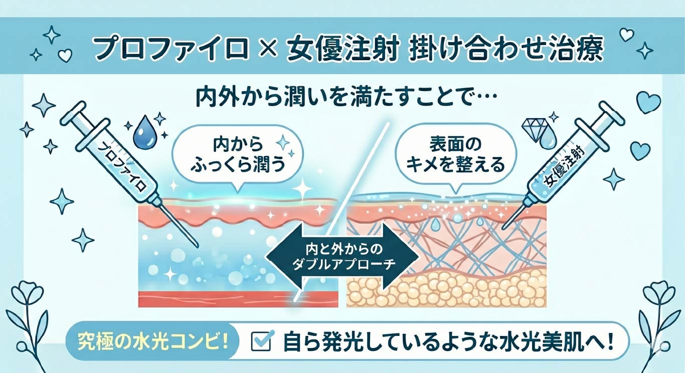 プロファイロ×女優注射