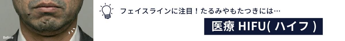医療ハイフイメージ1