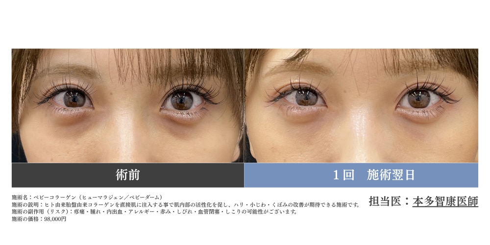 まずは症例写真をご覧ください！👀