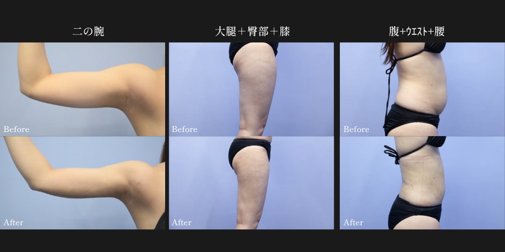 20代