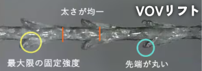 ② ダウンタイム少なめで、初めての人に → VOVリフト