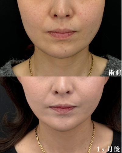 失敗パターン2：医師の症例を確認しなかった