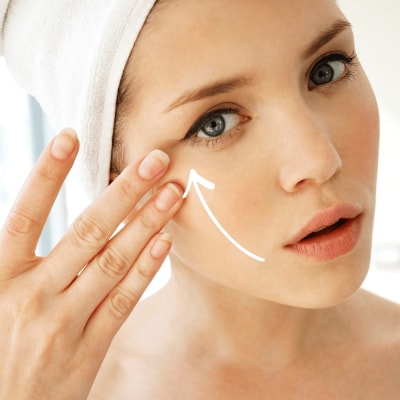 ② 中顔面の“間延び”に最も効果的な糸