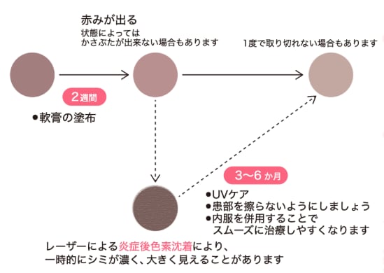 どのような施術か。