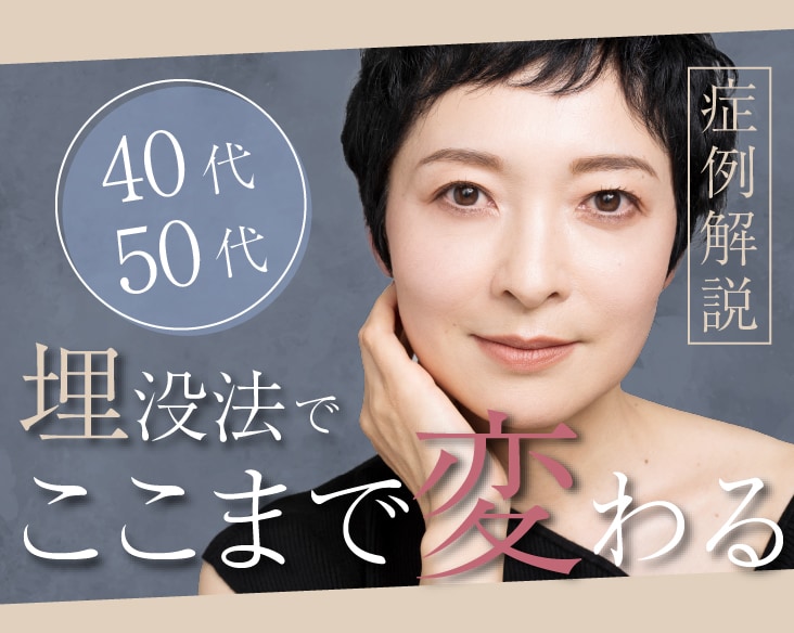 【40代、50代】まぶたのたるみに悩む世代の埋没法症例を徹底解説！埋没法でアンチエイジングはできる？