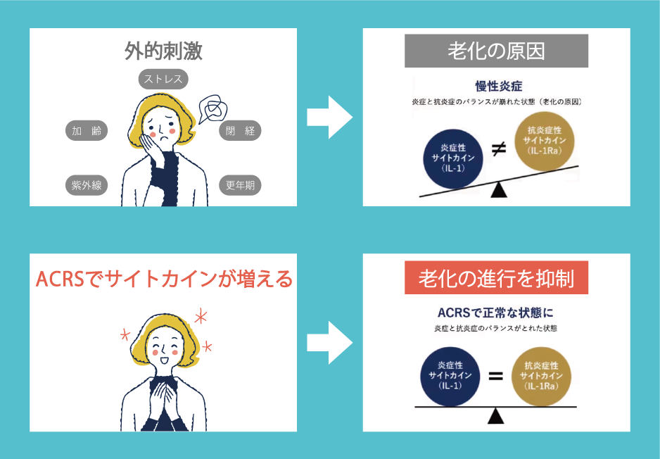 老化の原因とACRSの抗炎症作用による効果とは？