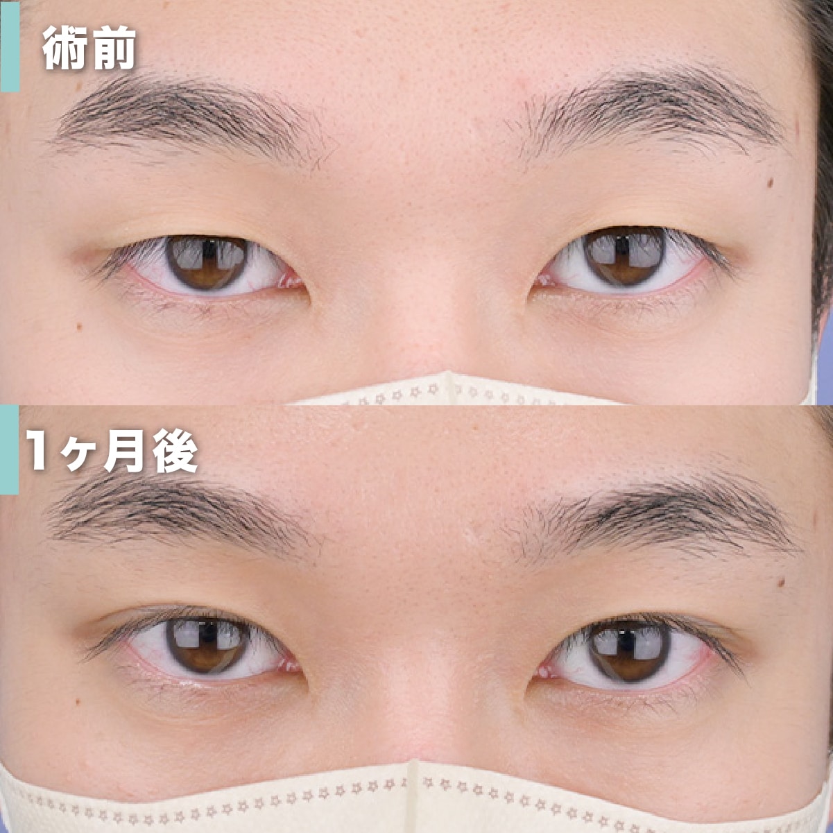 二 重 男子