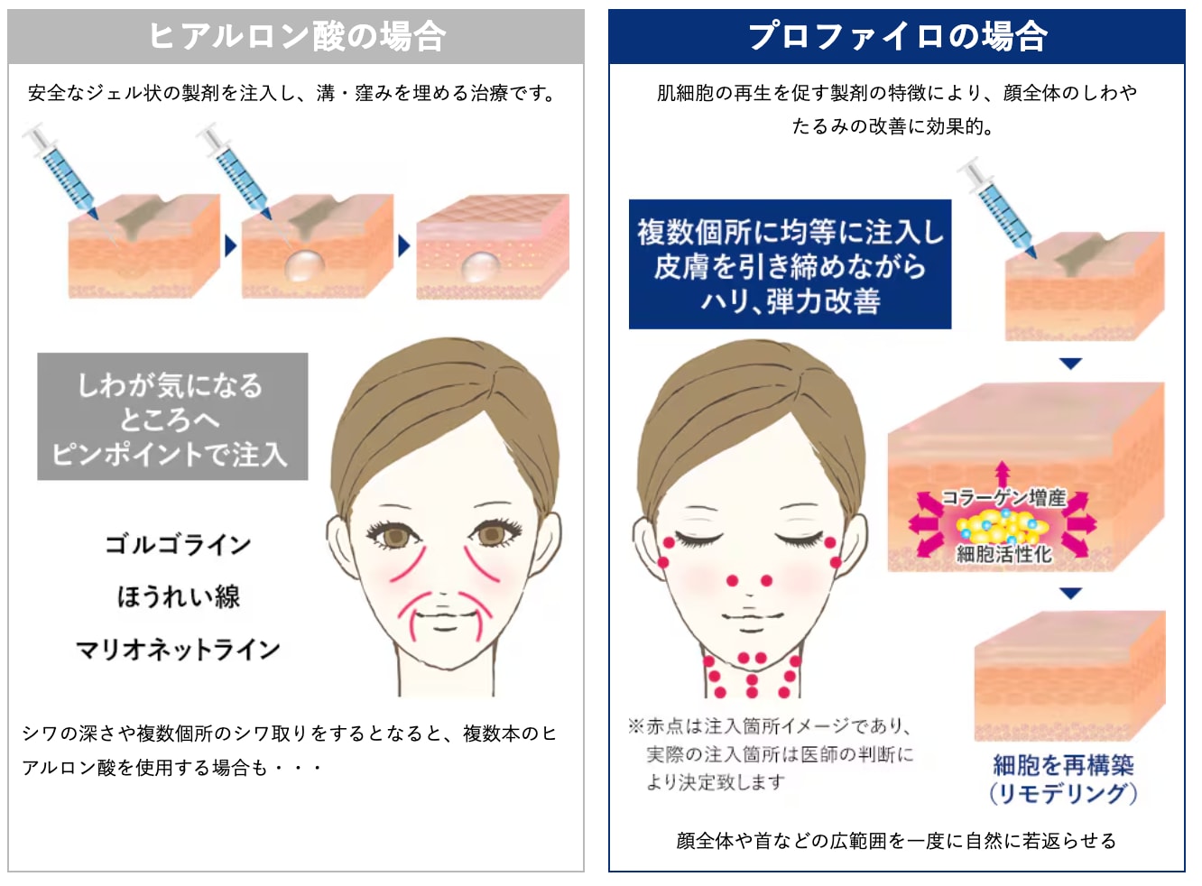 従来のヒアルロン酸となにが違う?